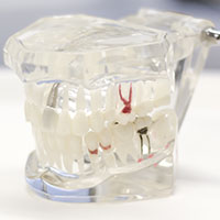 Zahnreinigungsgerät zur Prophylaxe